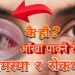 आँखा पाक्ने रोग फैलियो , कसरी जोगिने ?